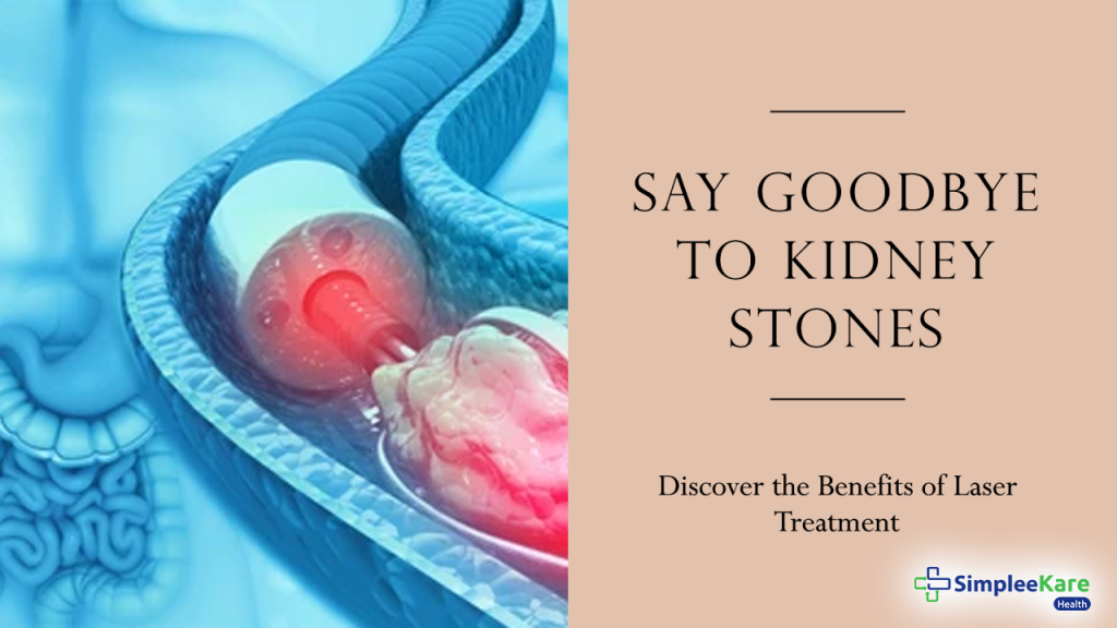 Kidney stone laser treatment