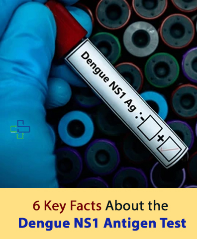 Dengue NS1 Antigen test image