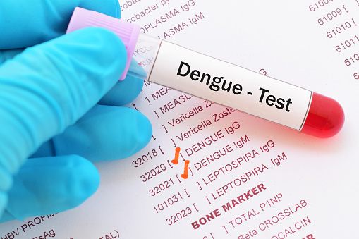 Dengue Profile Test Image
