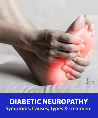 Symptoms and treatment of Diabetic Neuropathy