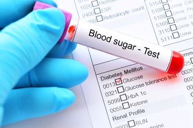 blood glucose (sugar) test near me 