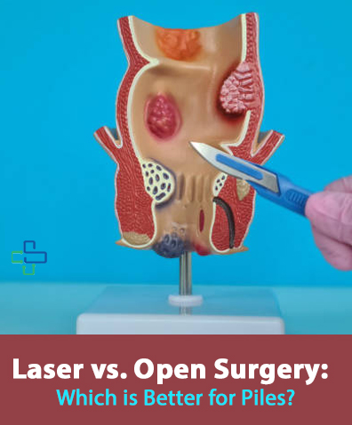 open vs laser piles surgery blog by simpleekare, bhubaneswar