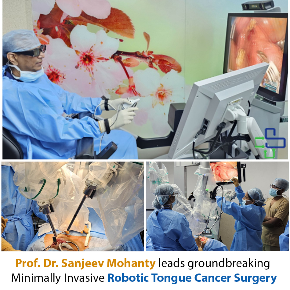 ROBOTIC-TONGUE-CANCER-SURGERY-DR-SANJEEV-MOHANTY BHUBANESWAR
