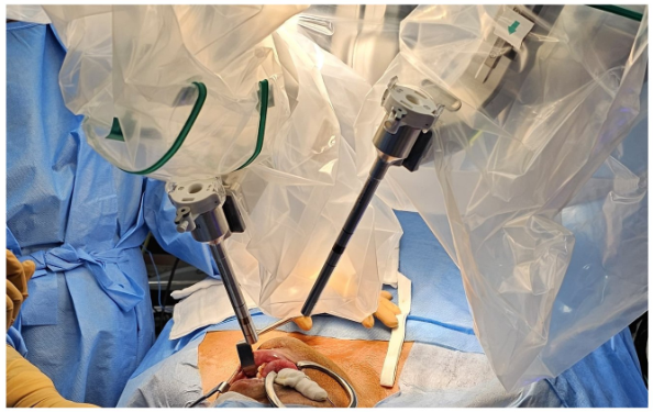 ROBOTIC TONGUE CANCE SURGERY