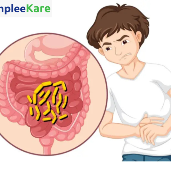 Cholera: Causes, Symptoms, Treatment & Prevention