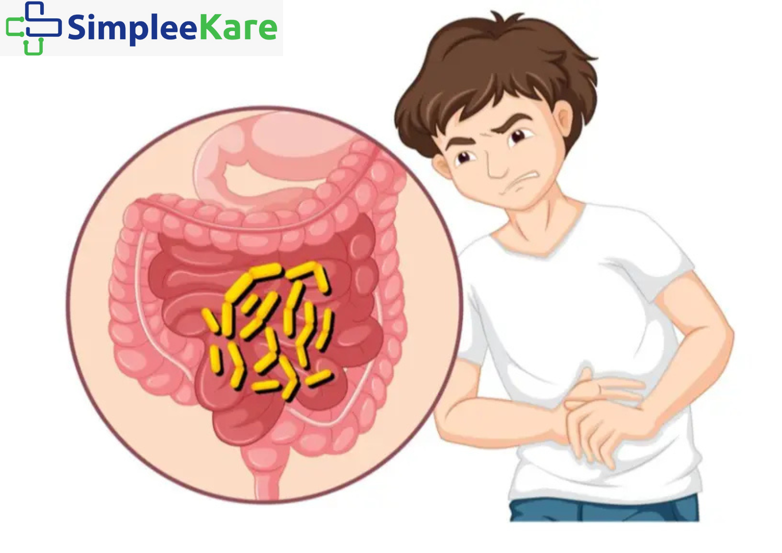 Cholera: Causes, Symptoms, Treatment & Prevention