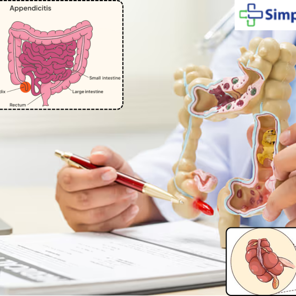 best hospital for appendix surgery