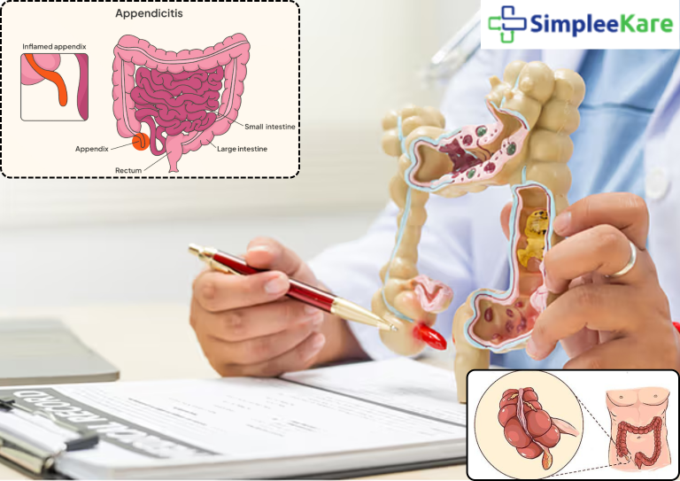 best hospital for appendix surgery