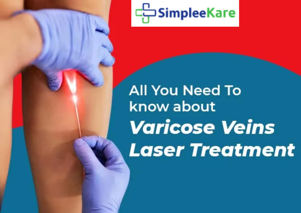 varicose veins clinic near me