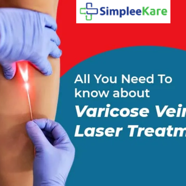 varicose veins clinic near me