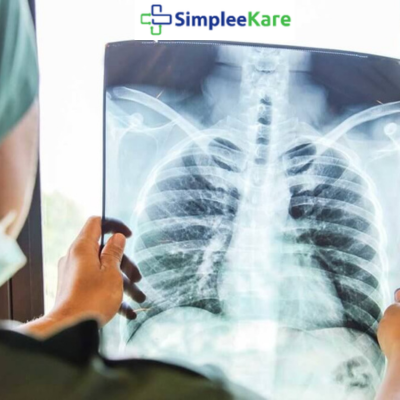 X-Rays: Uses, Preparation, Cost & More – SimpleeKare