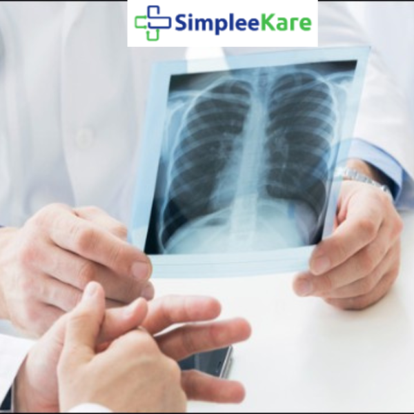 x-ray simpleekare health