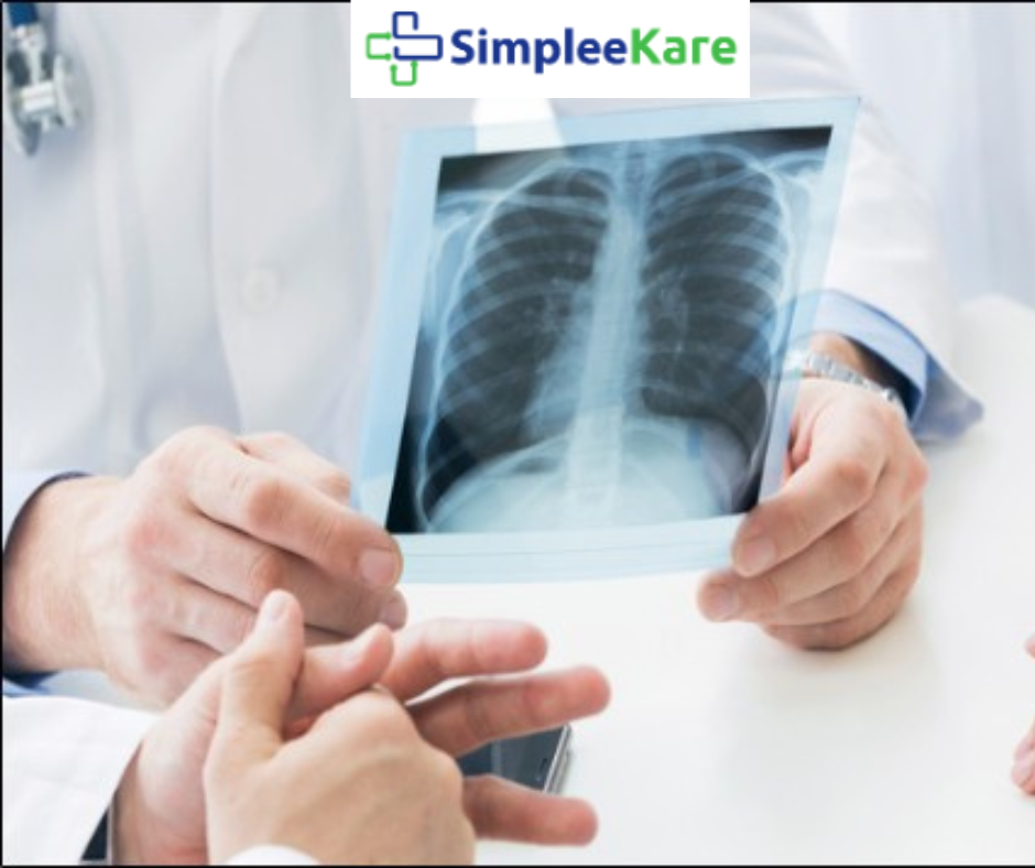 x-ray simpleekare health