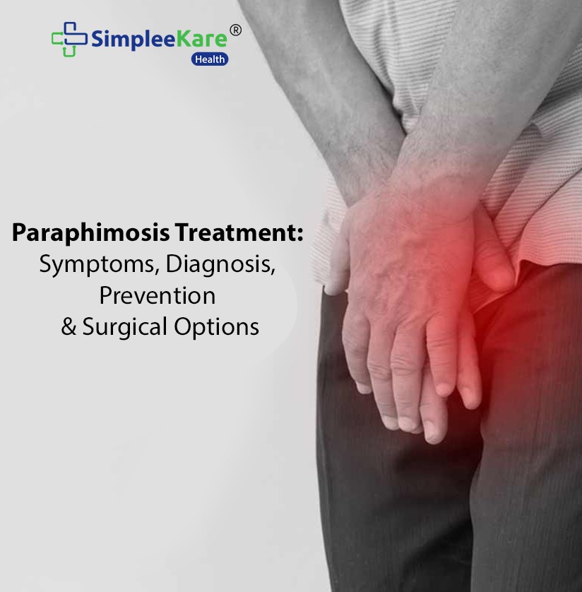 Paraphimosis Treatment: Symptoms, Diagnosis, Prevention & Surgical Options